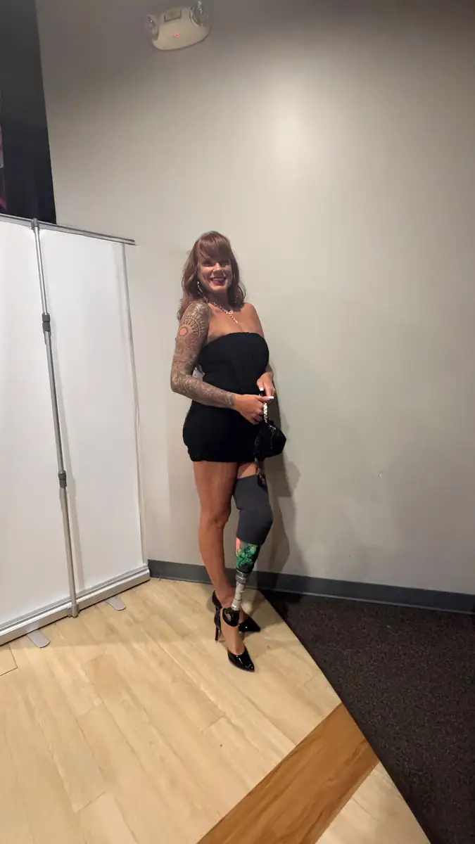 A patient walking the stage at the Quantum Clinics Fashion Show